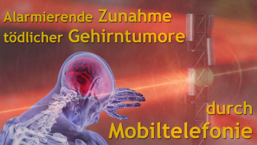 Alarmierende Zunahme tödlicher Gehirntumore (Glioblastome) durch Mobiltelefonie