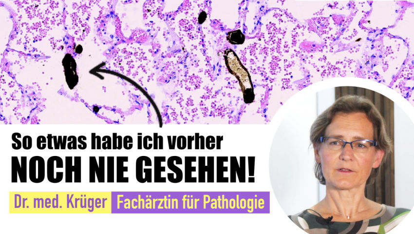 mRNA Corona Impfung – Ursache von Krankheit und Tod?! Interview mit Frau Dr. med. Ute Krüger